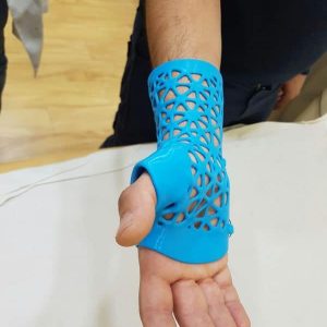 FÉRULAS 3D EN ALICANTE