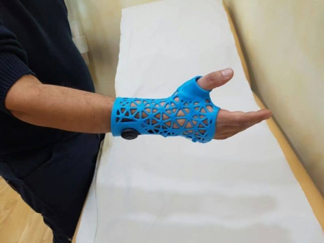 FÉRULAS 3D EN ALICANTE