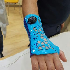 FÉRULAS 3D EN ALICANTE